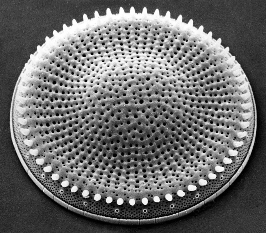 Photo of diatom
